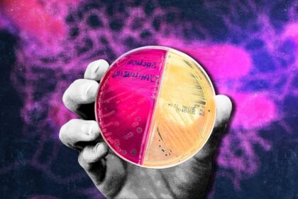 Why are there so many Salmonella outbreaks? 4 reasons for the nonstop food recalls, sicknesses, and safety warnings this year